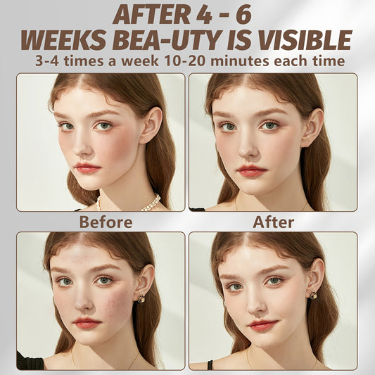 FDA Cleared Red Light Therapy Mask For Face And Neck - Silicone LED Facial Device To Reduce Wrinkles, Diminish Fine Lines And Brighten Skin Tone - Hands-Free Home Skincare System, Perfect Beauty Gift